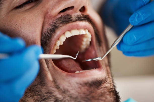 Dentist for Dental Trauma in MI